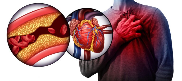 Understanding Heart Attack and Its Symptoms